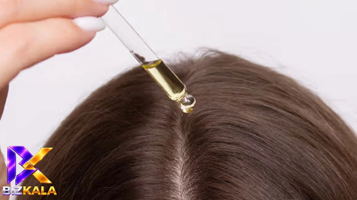 سولوشن مو برای چه نوع ریزشی مناسب است؟